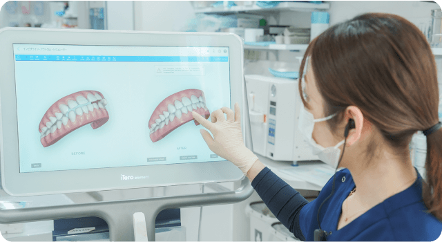 スマイルモア矯正が選ばれる理由は治療後のイメージをシミュレーションできること