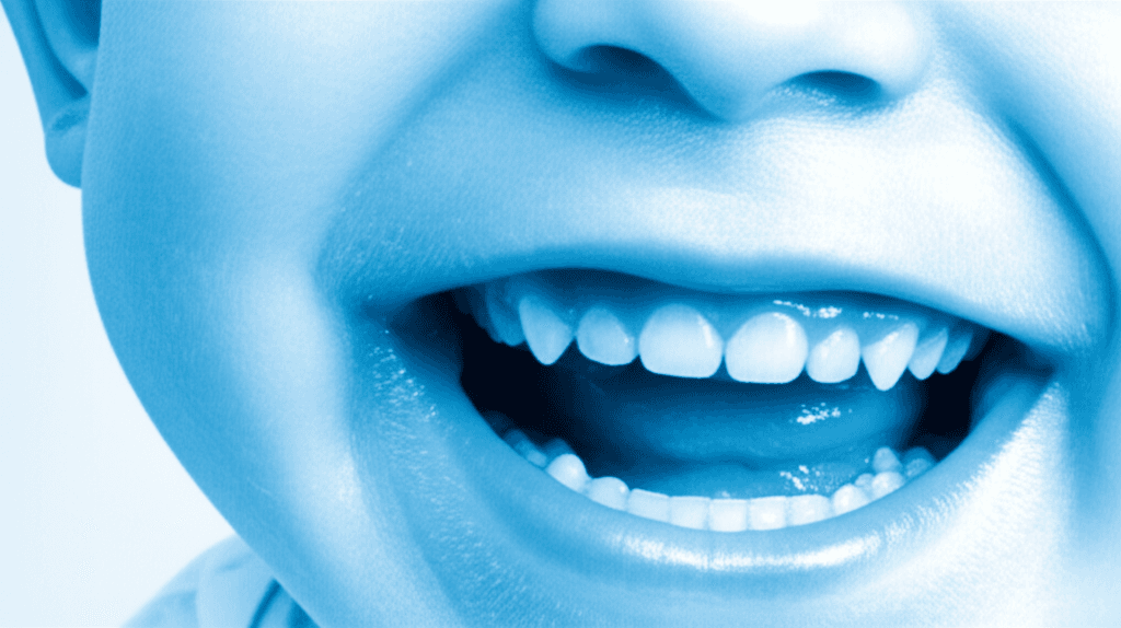 6〜12歳のIII級不正咬合患者に対するPostnikov装置、フェイスマスク、およびブラケットシステムを用いた矯正治療