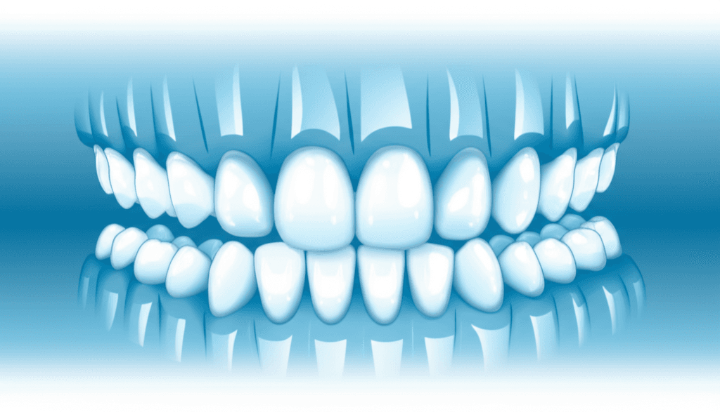 固定式矯正装置装着後の疼痛認知に対する口頭および書面による情報の効果:ランダム化比較試験