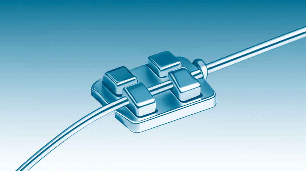 固定式矯正装置治療中のエナメル質脱灰を予防するためのシーラントおよびボンディング材の有効性:システマティックレビューおよびメタ解析