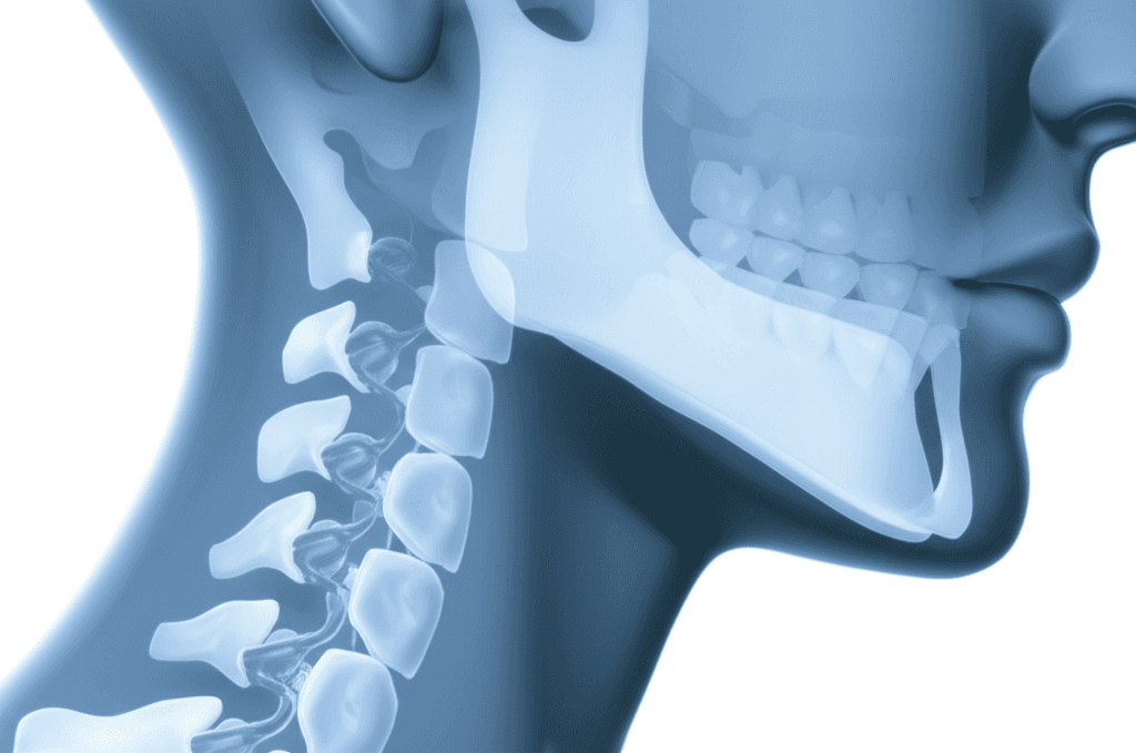 固定式矯正装置の装着が治療初期段階の口腔関連QOLに及ぼす影響