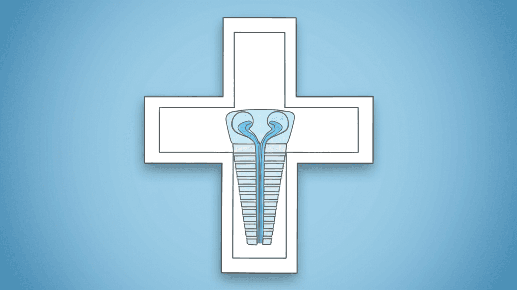 固定式装置を用いた矯正治療に伴う歯根吸収の関連因子:システマティックレビューおよびメタ解析